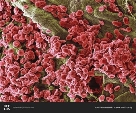 Magnification of red blood cells under Color scanning electron micrograph. stock photo - OFFSET