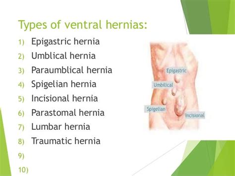 Epigastric Hernia Types