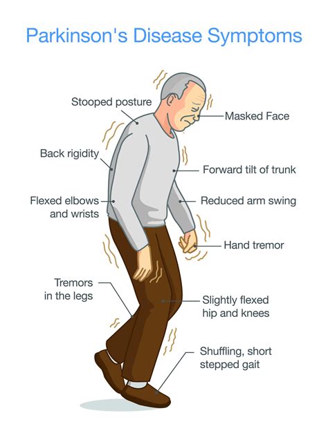 Symptoms of Parkinson's | APDA