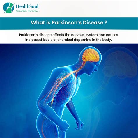 Parkinson’s Disease: Symptoms, Diagnosis and Treatment – Healthsoul