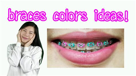 31+ Best Colors For Braces PNG