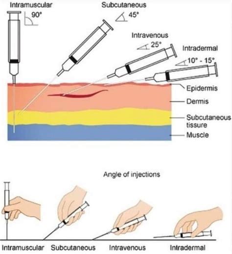 Injection guide - 9GAG