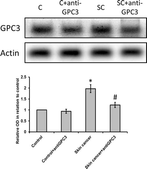 Representative images and statistical analysis of Western blot analysis... | Download Scientific ...