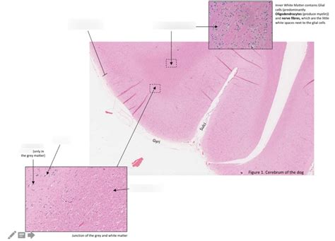 PRAC - neuro histology cerebrum of dog Diagram | Quizlet