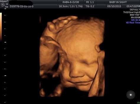 30 weeks pregnant 3d ultrasound - worldinriko