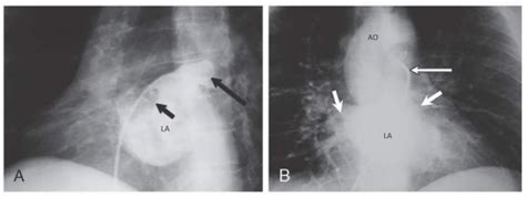 Pulmonary Angiography | Thoracic Key