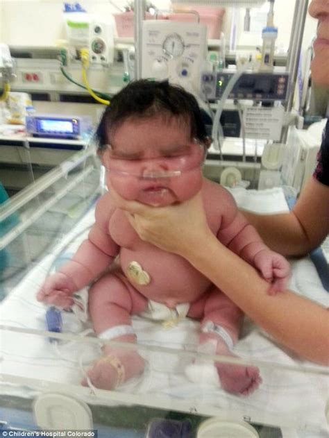 Colorado woman gives birth to FOURTEEN pound baby daughter | Daily Mail Online