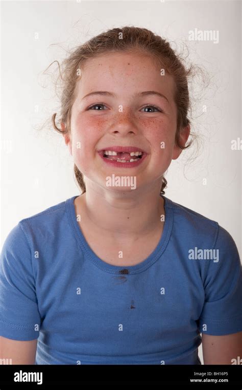 little girl smiling big through two missing front teeth Stock Photo - Alamy