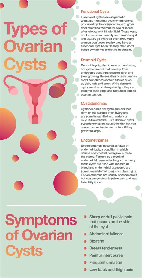 ovarian cyst symptoms - DrBeckmann