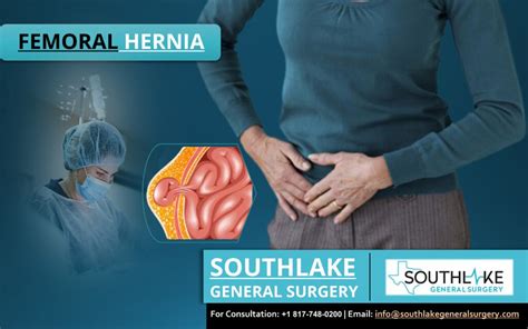 Femoral Hernia Surgery at Southlake General Surgery - Southlake General Surgery