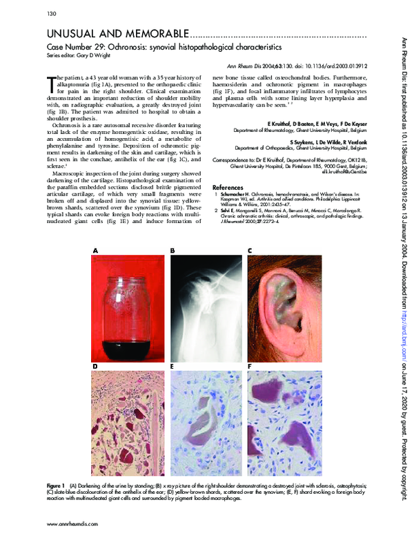 First page of “Case Number 29: Ochronosis: synovial histopathological characteristics”