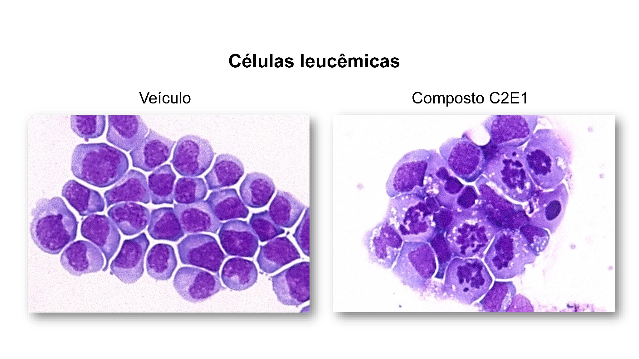 Molécula mostra potencial para combater a leucemia em testes pré-clínicos