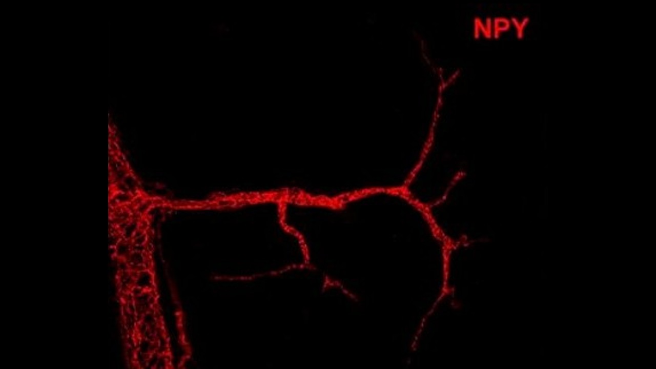 Estudo publicado na <i>Nature</i> revela novo fator envolvido no controle do gasto calórico