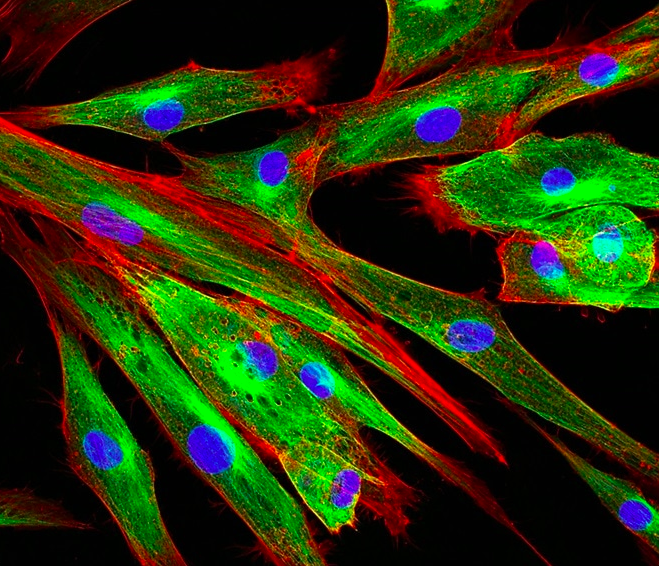 extracellular matrix proteins aging Credit: Vshivkova/Shutterstock.com