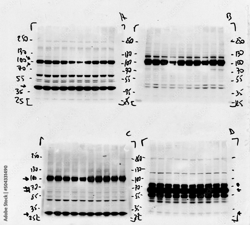 Skan of western blotting film with an image of four membranes subjected ...