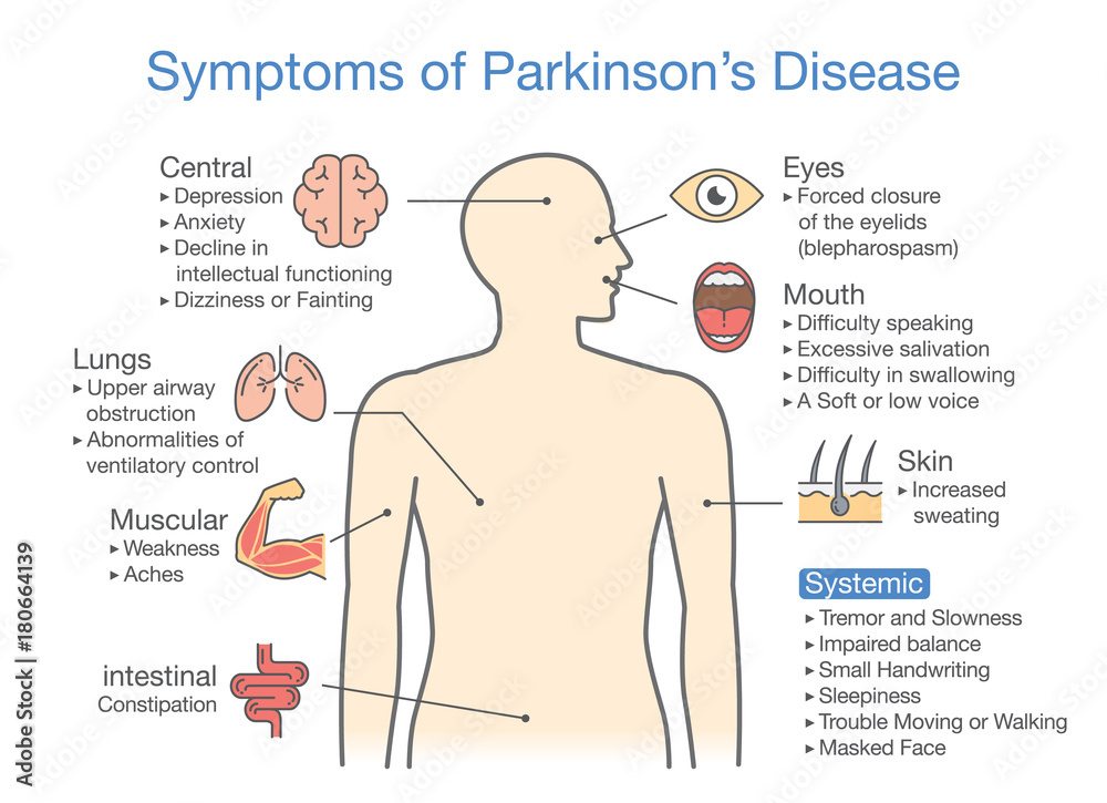 Parkinson's disease symptoms and signs. Illustration about medical ...