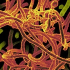 Ebola virus