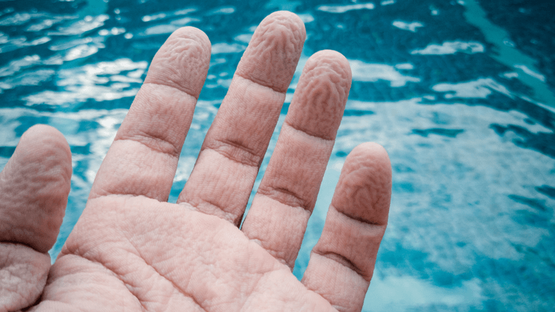 a hand with pruny fingers as it's been in the pool getting wet