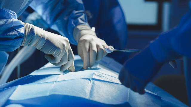 Close-up of surgeon with nurse and and assistant during operation. 