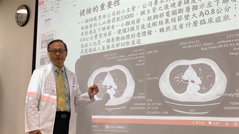 58歲老菸槍不想罰3千　檢查竟確診肺腺癌