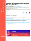 Research paper thumbnail of Detection of cardiac arrhythmia patterns in ECG through <i>H</i> <b>×</b> <i>C</i> plane