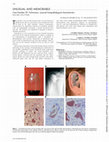 Research paper thumbnail of Case Number 29: Ochronosis: synovial histopathological characteristics