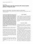 Research paper thumbnail of Clear cell type of renal cell carcinoma with numerous hyaline globules: A diagnostic pitfall