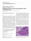 Research paper thumbnail of Conventional renal cell carcinoma with granulomatous reaction: a report of three cases