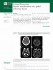 Research paper thumbnail of Clinical Reasoning: Myriad manifestations of a global infectious disease