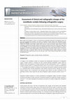 Research paper thumbnail of Assessment of clinical and radiographic changes of the mandibular condyle following orthognathic surgery