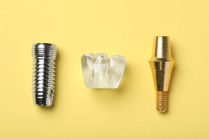 livonia dental implants