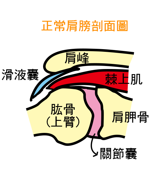 3大肩膀痛症狀 肩夾擠症候群 正常肩膀剖面圖