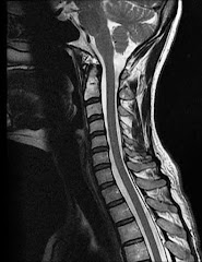 Spinal Section