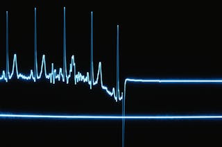 心電圖＿死亡＿Flatline on a Heart Monitor