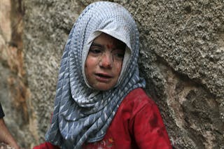 An injured girl reacts during what activists said were air strikes by forces loyal to Syria's President Bashar Al-Assad, in the 