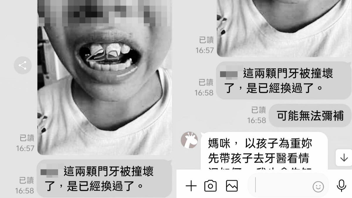 媽媽指出，兒子被同學騎頭上打斷牙。（圖／翻攝自臉書「爆料公社」）