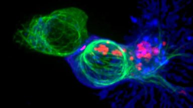 image shows a cytotoxic T cell attacking a cancer cell by releasing toxic chemicals