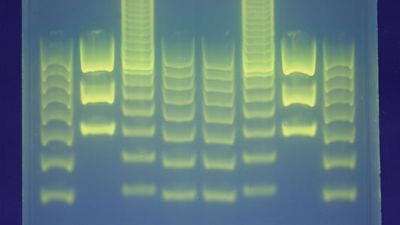 In DNA fingerprinting, fragments of DNA are separated on a gel using a technique called electrophoresis. This creates a pattern that can be analyzed and that is unique to each individual, with the exception of identical twins.