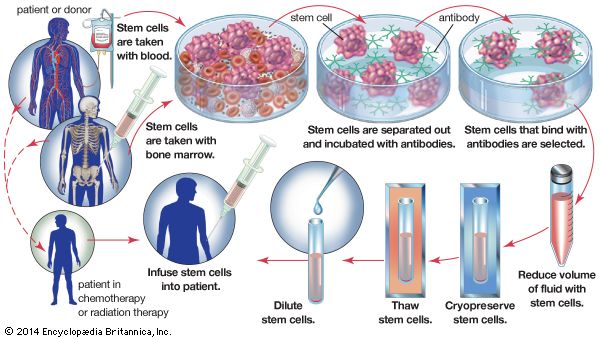 bone marrow transplantation