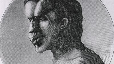 Joseph Merrick