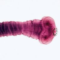 Scolex (head) of the tapeworm Taenia solium.  The hooks of the scolex enable the tapeworm to attach to the intestinal wall.