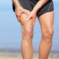 Muscle injury. Man with sprain thigh muscles. Athlete in sports shorts clutching his thigh muscles after pulling or straining them while jogging on the beach.