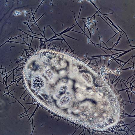 Discharged trichocysts of Paramecium (highly magnified)