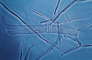 xylem tracheids