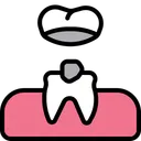 Free Veneers Material Layer Teeth Crown Icon