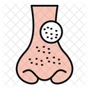 Blackhead  Icon