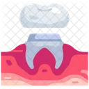 Dental Crown  Icon