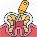 Root Canal Treatment Symbol