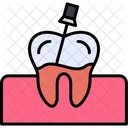 Root Canal Canal Dental Symbol