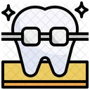 Tooth Braces  Icon